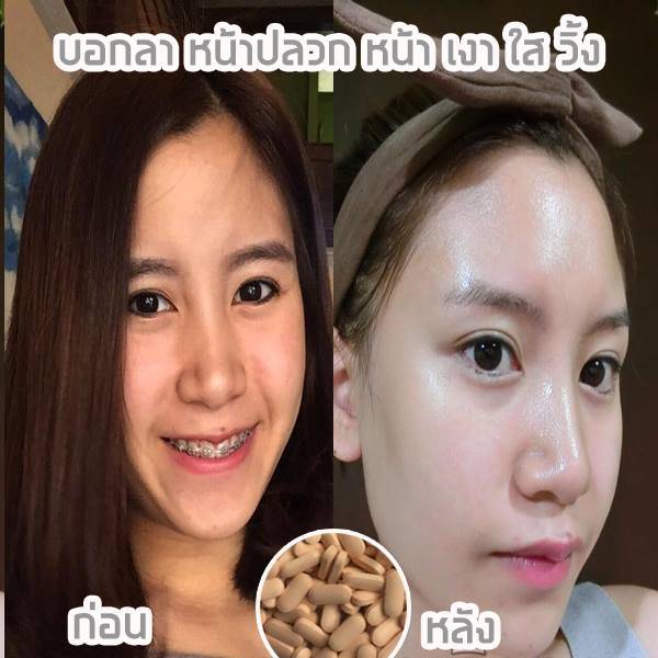 5g.jpg